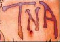 Logo TNA